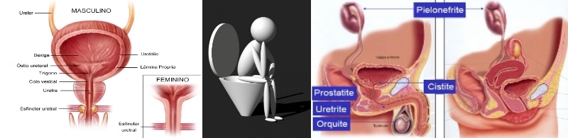 Incontinência urinária e Infeções do trato urinário
